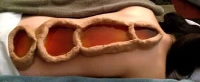 Spine Basti – ayurvedinen selkärangan öljyhoito, 60 min